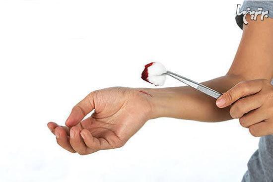 راه های مراقبت از زخم دیابت راه های مراقبت از زخم دیابت